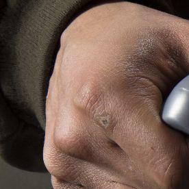 Refrigerante de autos