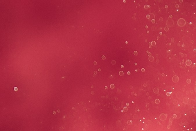 Inyectores de diesel.