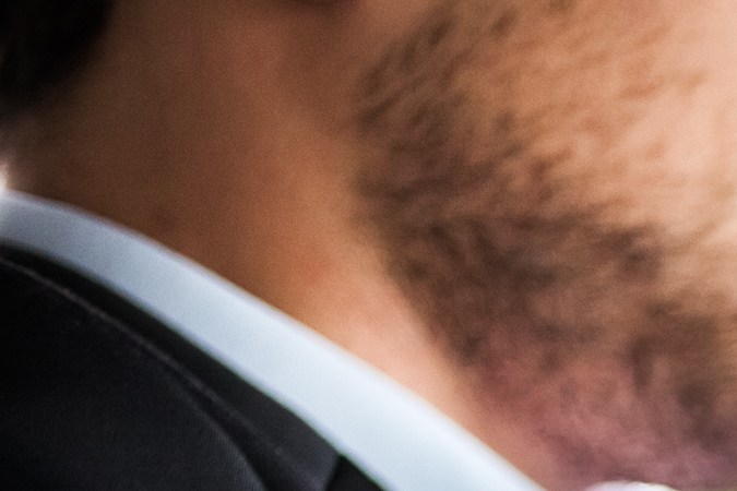 Qué es la dirección asistida