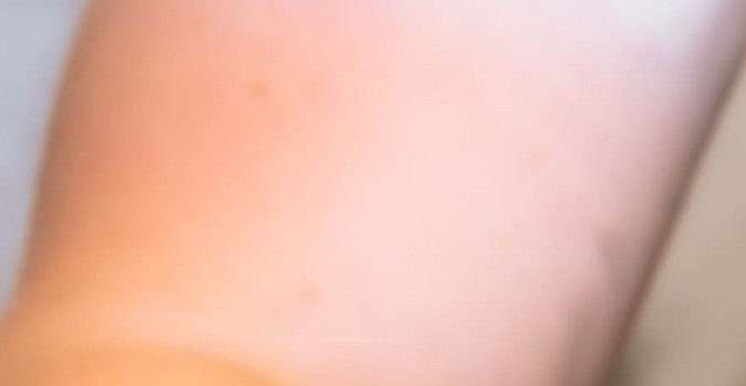 que es arbol de levas del carro funcion sintomas de fallas
