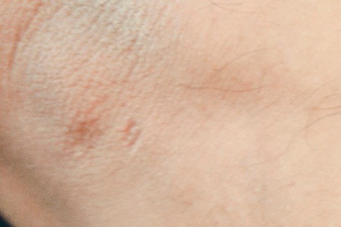 caja de cambios dañada o gastada