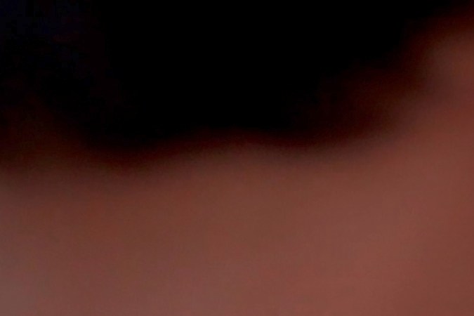 ¿Cuánto puedo cobrar por un latigazo cervical?