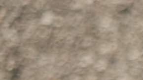 Heridas más comunes en un accidente de auto