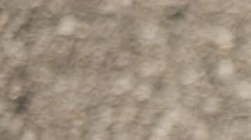 Heridas más comunes en un accidente de auto