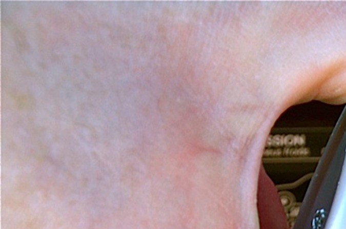 Conoce los efectos secundarios de Cataclean y cómo proteger tu motor.