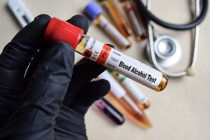 prueba de alcohol en la sangre