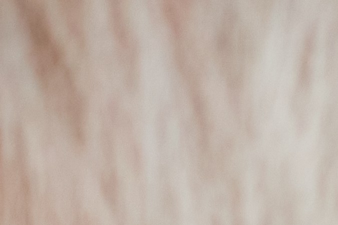 problemas auditivos en conductores